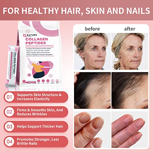 Multi Collagen Peptides Powder Type I II III V X Hydrolyzed Collagen Peptides with Prebiotics Sugar-Free Non-GMO X785764